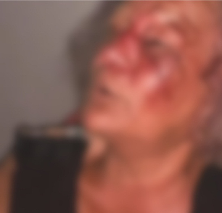 Foto: Reprodução / PMPI